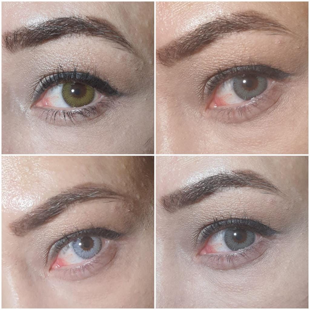 Astigmatlı Renkli Lens Kullanımı: Torik Lensler ile Hem Görüş Hem Estetik