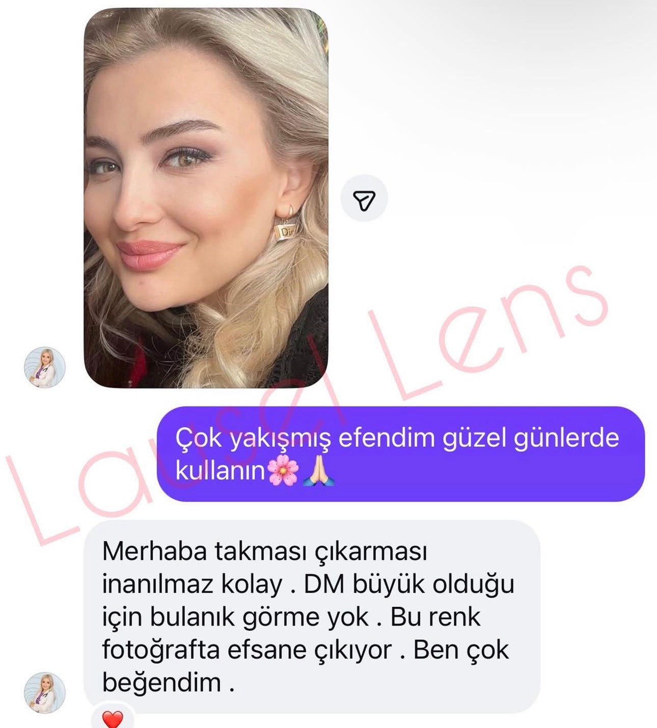 Doğal lenslerim geldi çok memnunum